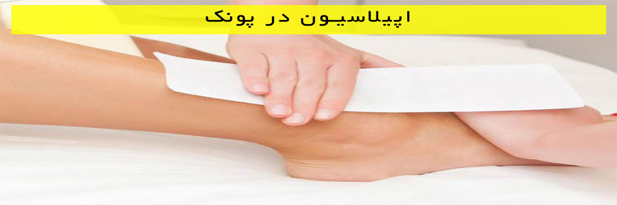 اپیلاسیون-در-پونک اپیلاسیون در پونک
