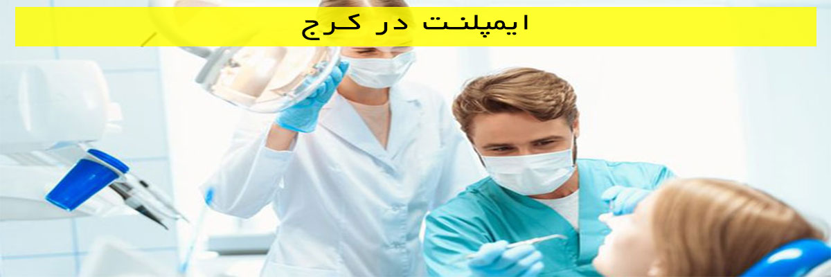 ایمپلنت در کرج