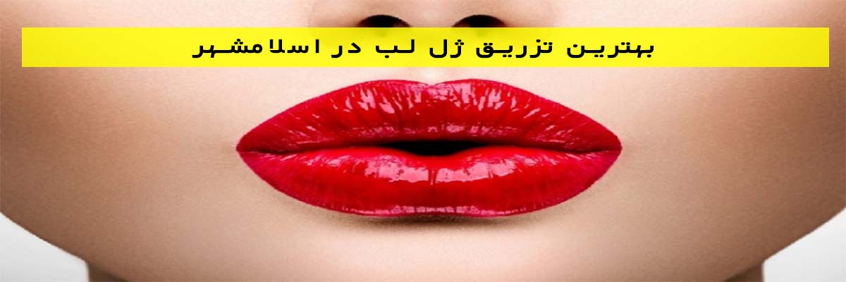 بهترین-تزریق-ژل-لب-در-اسلامشهر بهترین تزریق ژل لب در اسلامشهر