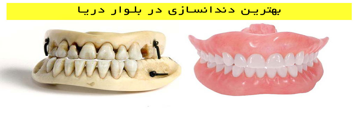 بهترین دندانسازی در بلوار دریا