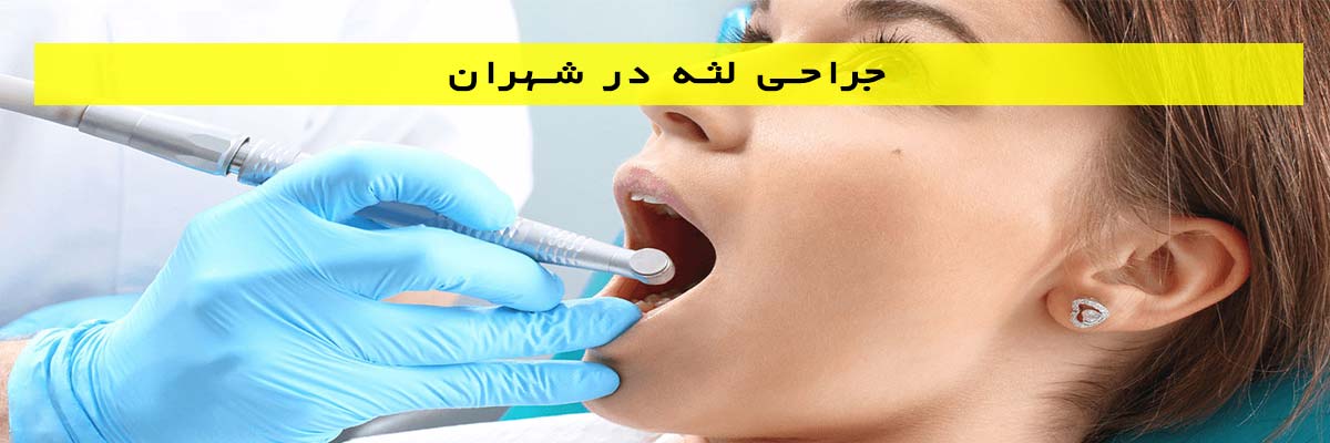 جراحی لثه در شهران