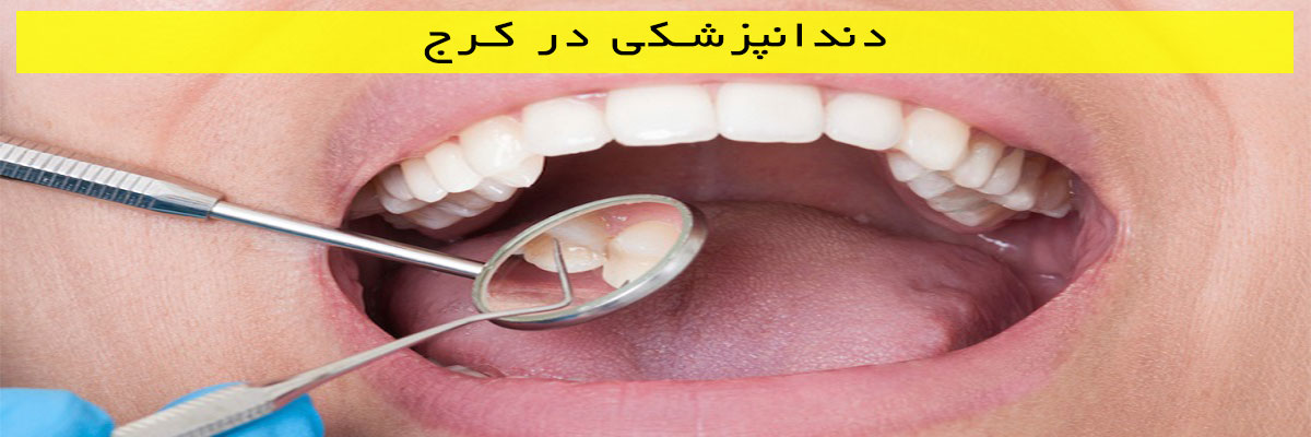 دندانپزشکی در کرج