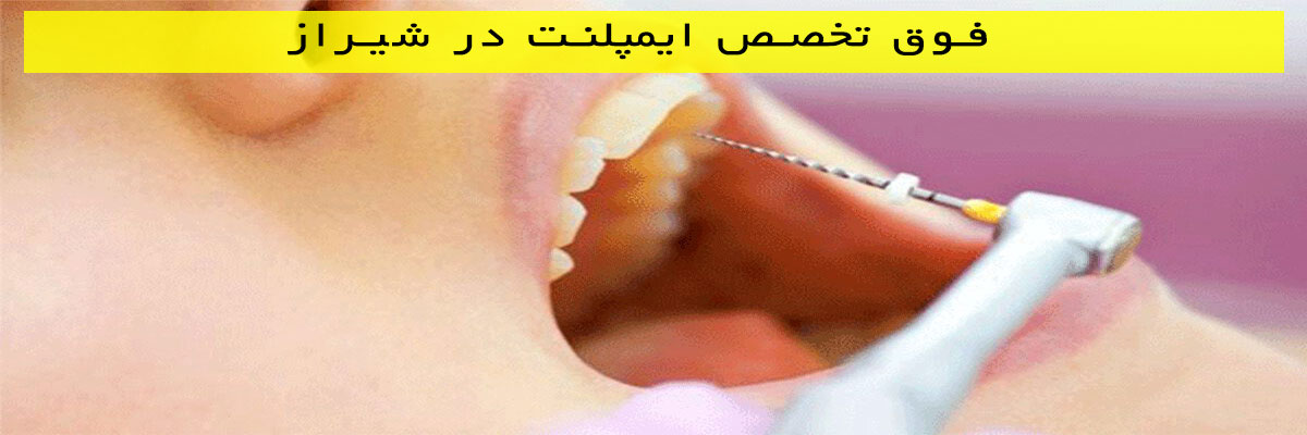 فوق-تخصص-ايمپلنت-در-شیراز فوق تخصص ايمپلنت در شیراز