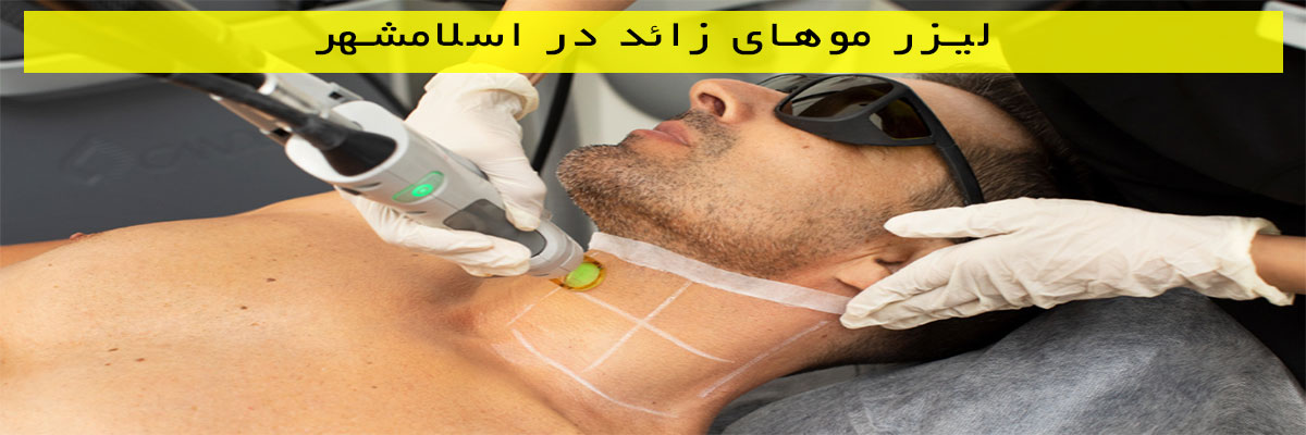لیزر-موهای-زائد-در-اسلامشهر لیزر موهای زائد در اسلامشهر