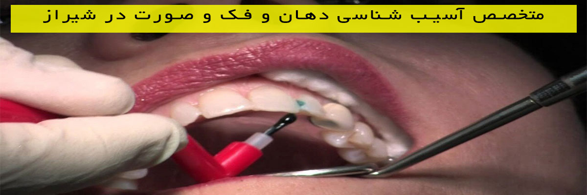 متخصص-آسیب-شناسی-دهان-و-فک-و-صورت-در-شیراز متخصص آسیب شناسی دهان و فک و صورت در شیراز