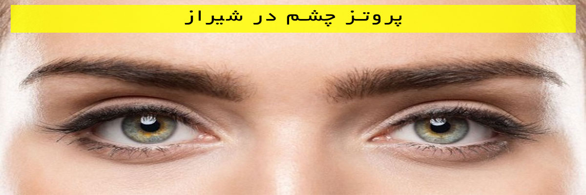 پروتز چشم در شیراز