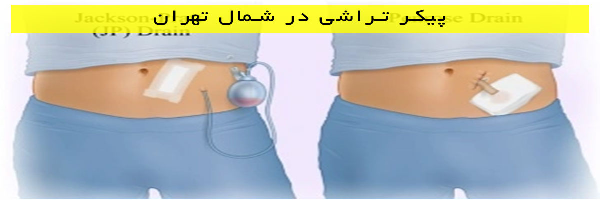 پیکر-تراشی-در-شمال-تهران پیکر تراشی در شمال تهران