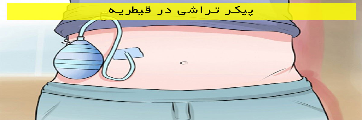 پیکر تراشی در قیطریه