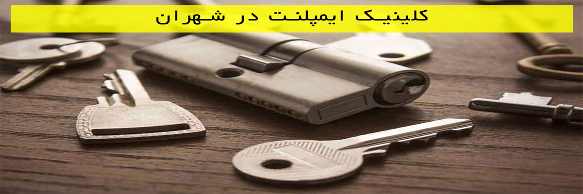 کلید-سازی-در-شمال-تهران کلید سازی در شمال تهران