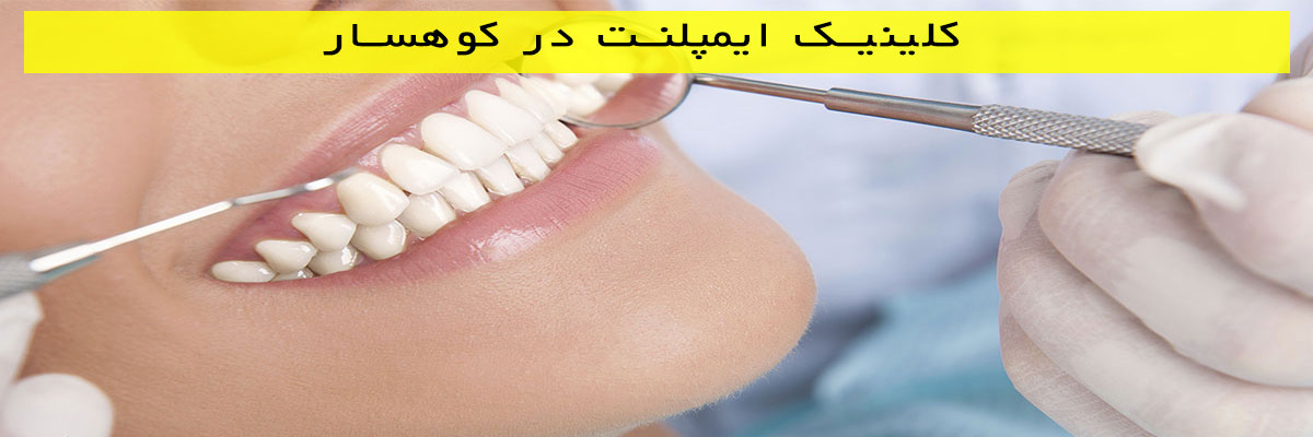 کلینیک-ایمپلنت-در-کوهسار کلینیک ایمپلنت در کوهسار