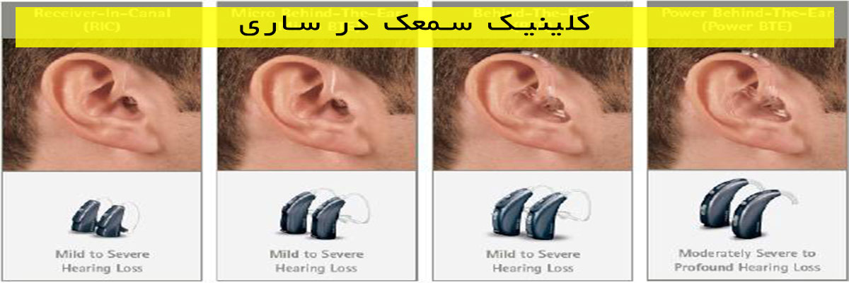 کلینیک-سمعک-در-ساری کلینیک سمعک در ساری